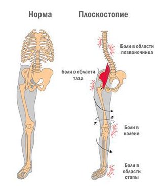 Фото: Хотите заметно улучшить здоровье? Начните со стоп! 
